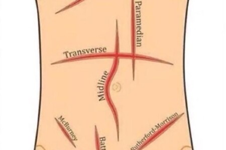 EXAMEN FÍSICO DE ABDOMEN